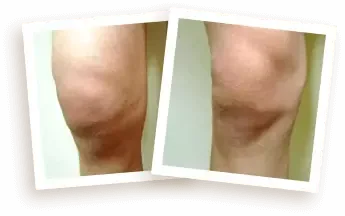 Ilustrasi kondisi sendi (contoh)